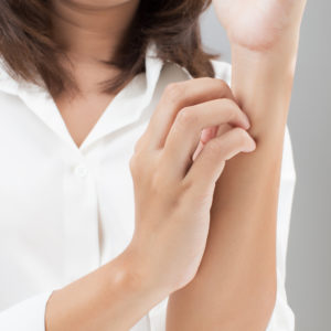 Choroby dermatologiczne skóry – wyprysk kontaktowy