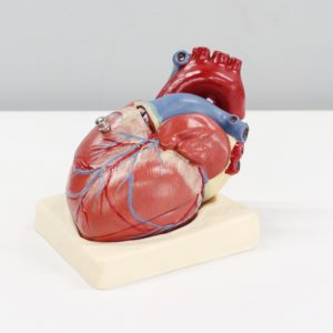 Tętniak aorty- czym jest i jak go leczyć?