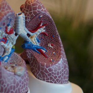 Przewlekła obturacyjna choroba płuc POChP