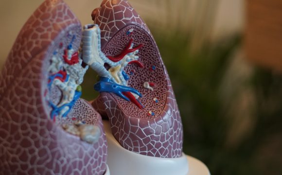 Przewlekła obturacyjna choroba płuc POChP